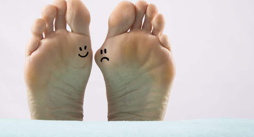 a close up bunion feet